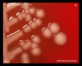 klebsiella pneumoniae colony detail, gamma-hemolysis, gamma-hemolytic colonies